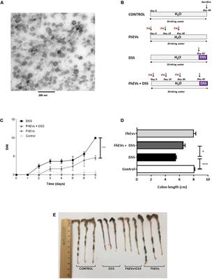 Extracellular Vesicles From the Helminth Fasciola hepatica Prevent DSS-Induced Acute Ulcerative Colitis in a T-Lymphocyte Independent Mode